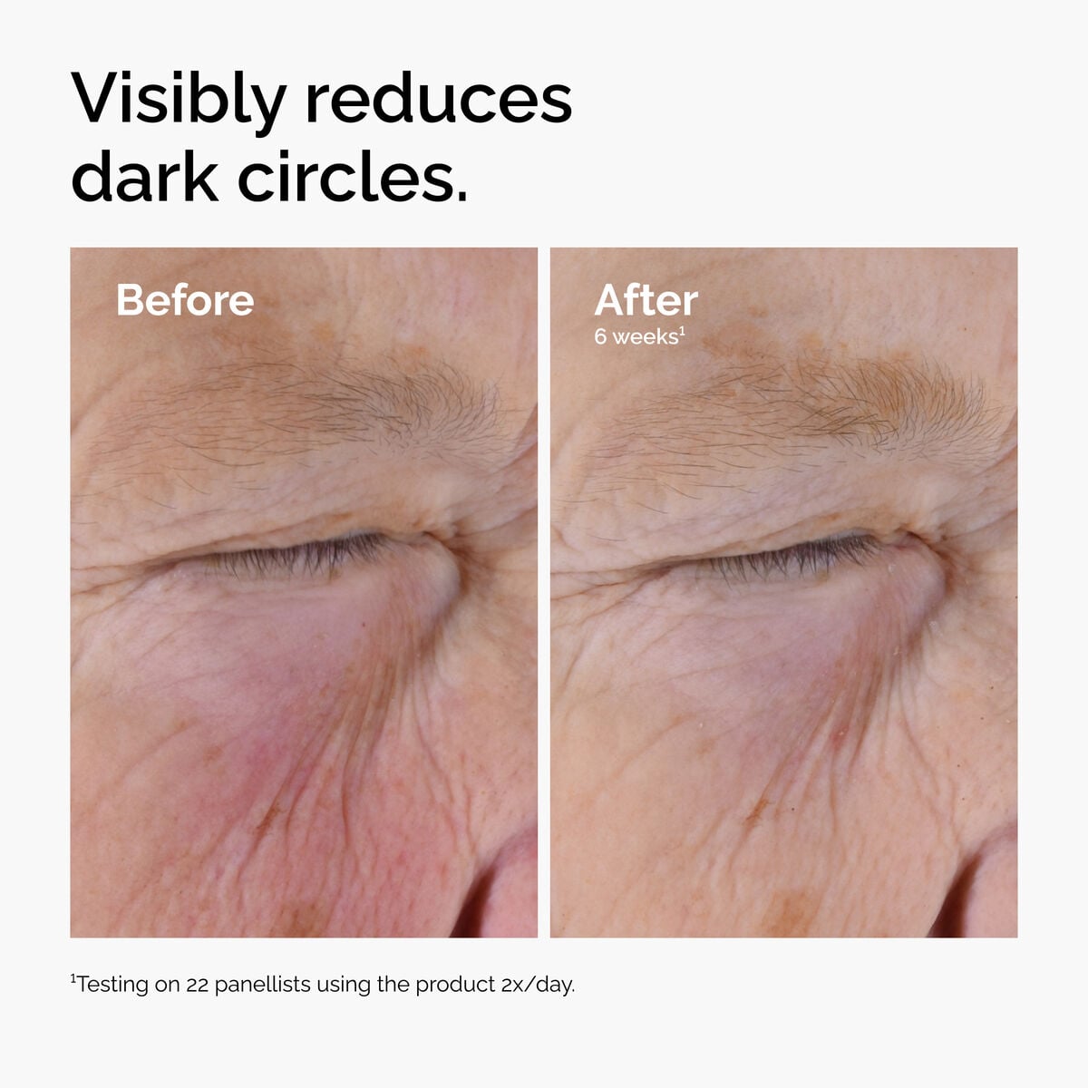 caffeine-solution-5-egcg-eye-serum-u9 ord-caffeine-solution-egcg-dark-circles-before-after.jpg