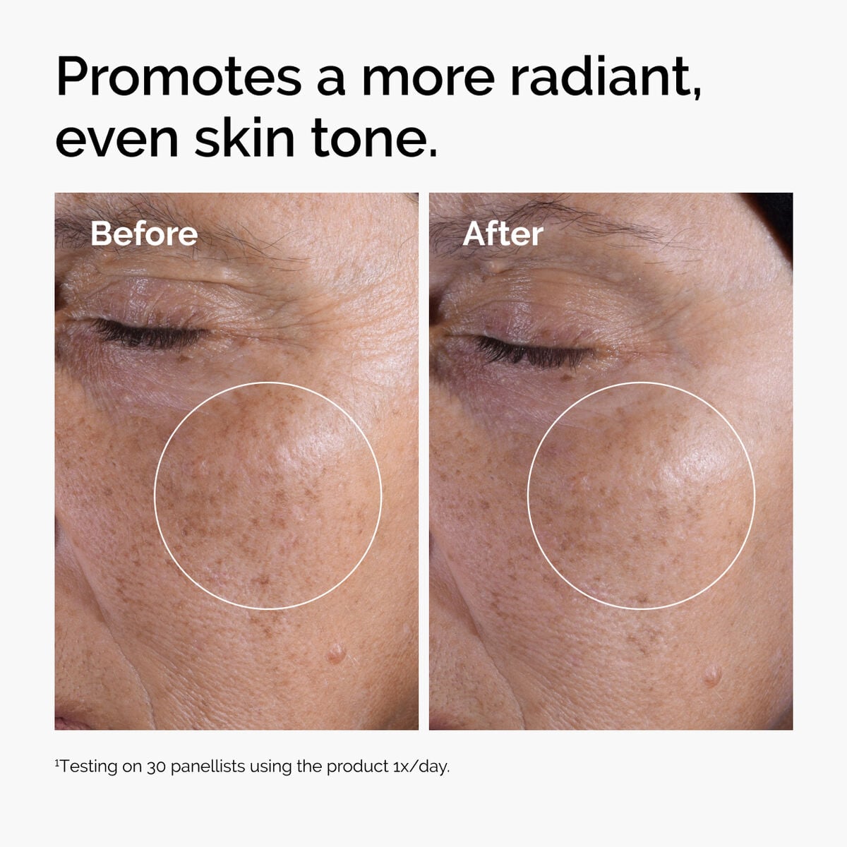 glycolic-acid-7-exfoliating-toner-q8 ord-glycolic-before-after-radiance.jpg