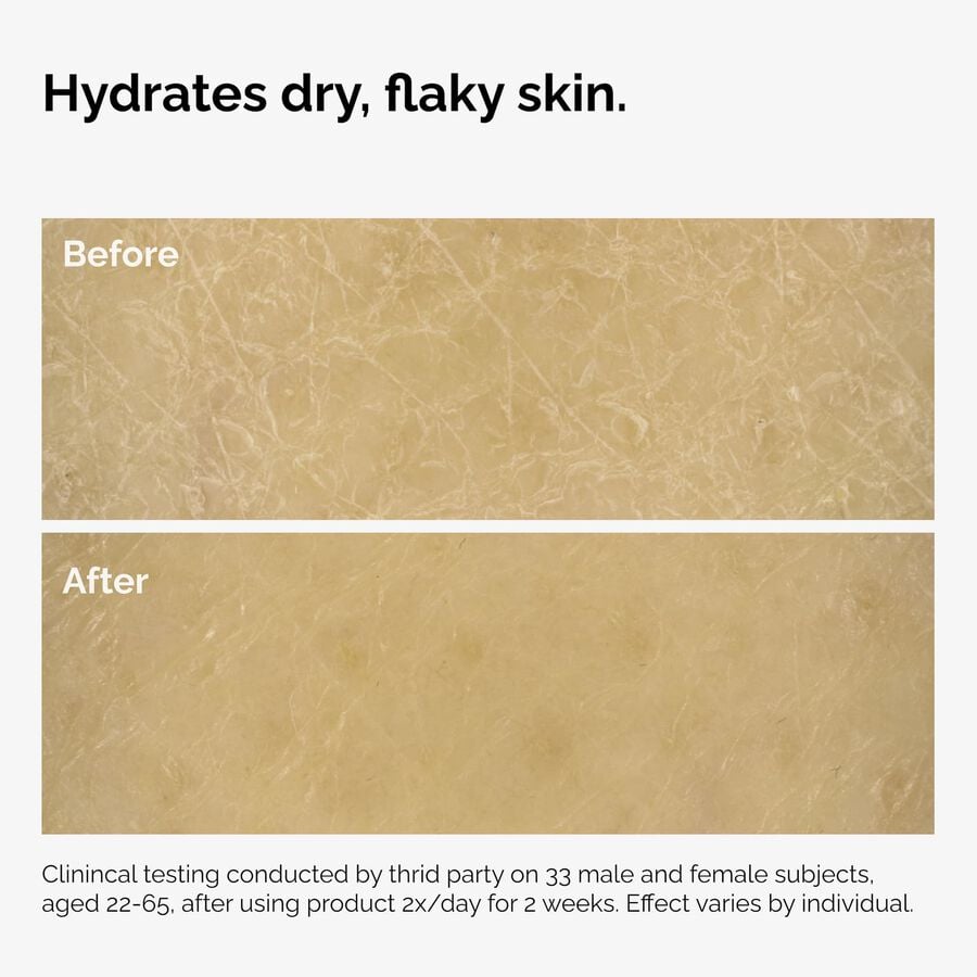 the-body-care-collection-l3 ord-natural-moisturizing-factors-inulin-body-before-after-graphic-02.jpg