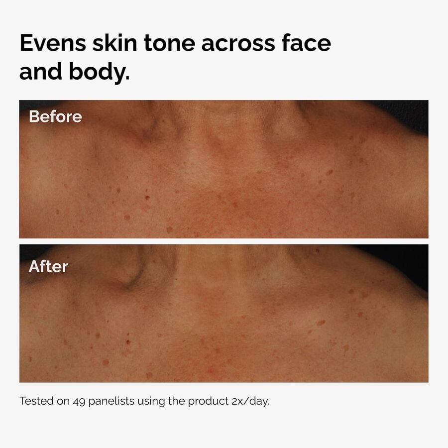 the-body-care-collection-l3 ord-niacinamide-face-body-serum-before-after-even-tone-graphic.jpg